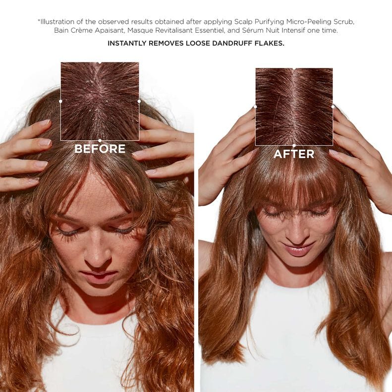 Scalp Purifying Micro-Peeling Scrub by Kerastase