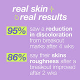 Dermalogica Clear Start Post-Spot Fix – 15 mL